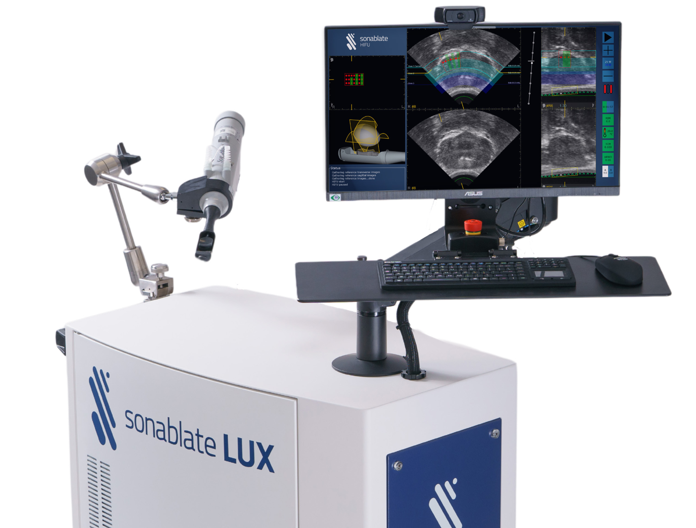 Sonablate LUX HIFU cihazı